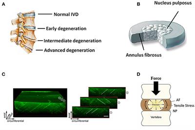 Strategies for Annulus Fibrosus Regeneration: From Biological Therapies to Tissue Engineering